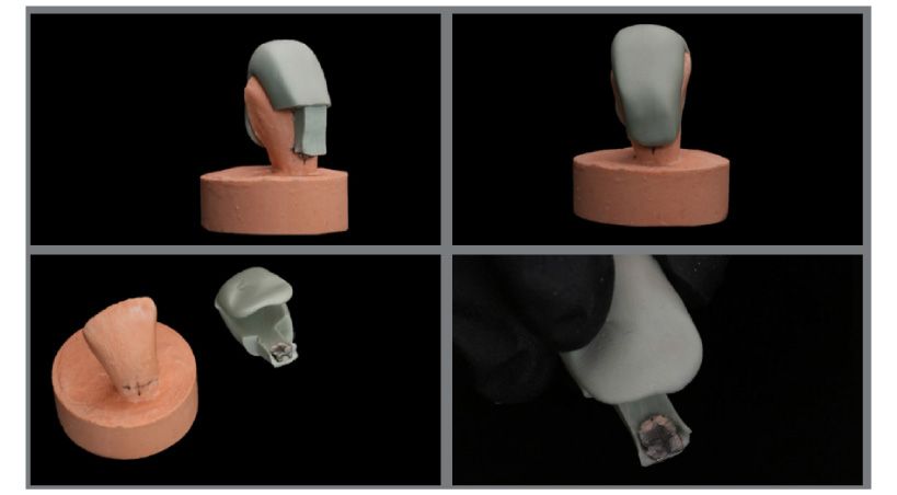 Interfieren en la adhesión los métodos de limpieza de la base de los brackets?