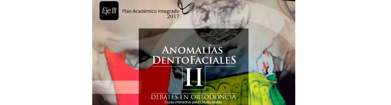 Anomalías Dentofaciales II