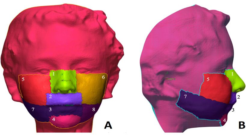 Cambios en los tejidos blandos durante la terapia ortopédica